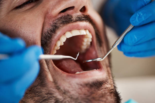 Best Teeth Whitening  in Woodlawn, OH