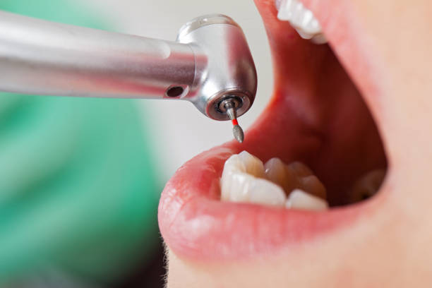Best Knocked-Out Tooth Emergency  in Woodlawn, OH